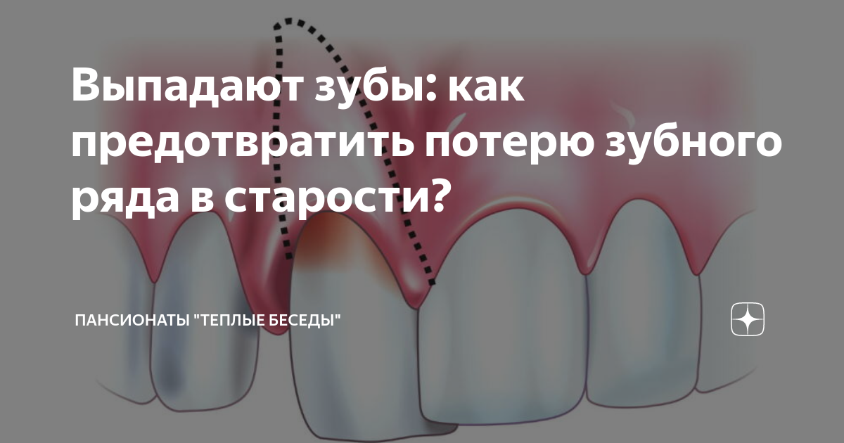 постоянные зубы растут в два ряда