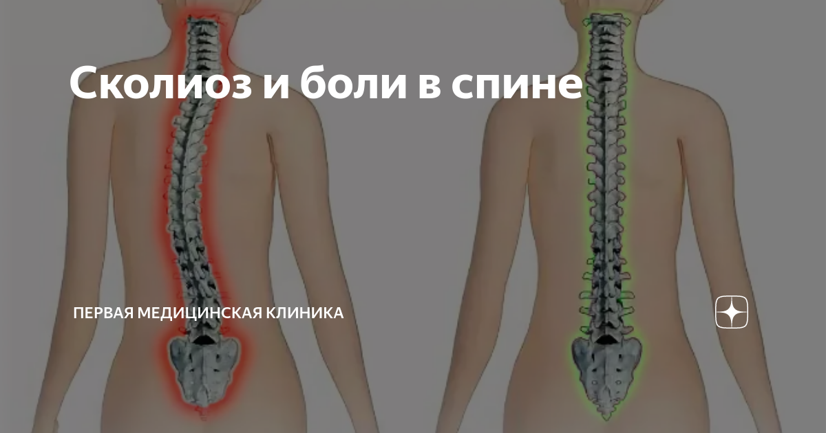 боль в пояснице. ниже поясницы. почему спина холодная. фото нарушенной статики шеи. почему спина холодная.