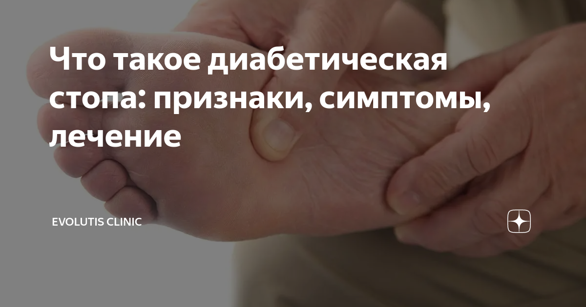 что такое диабетическая стопа фото
