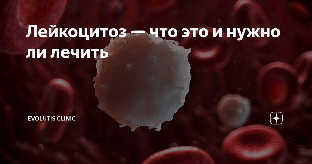 Evolutis