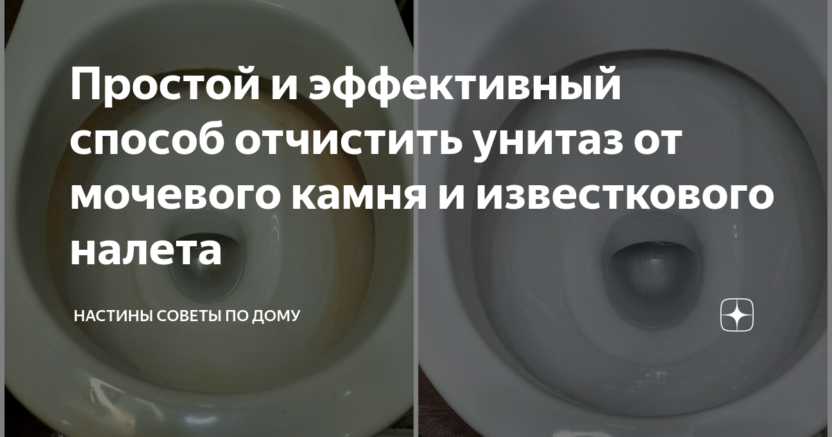 как очистить унитаз от мочевого камня отзывы