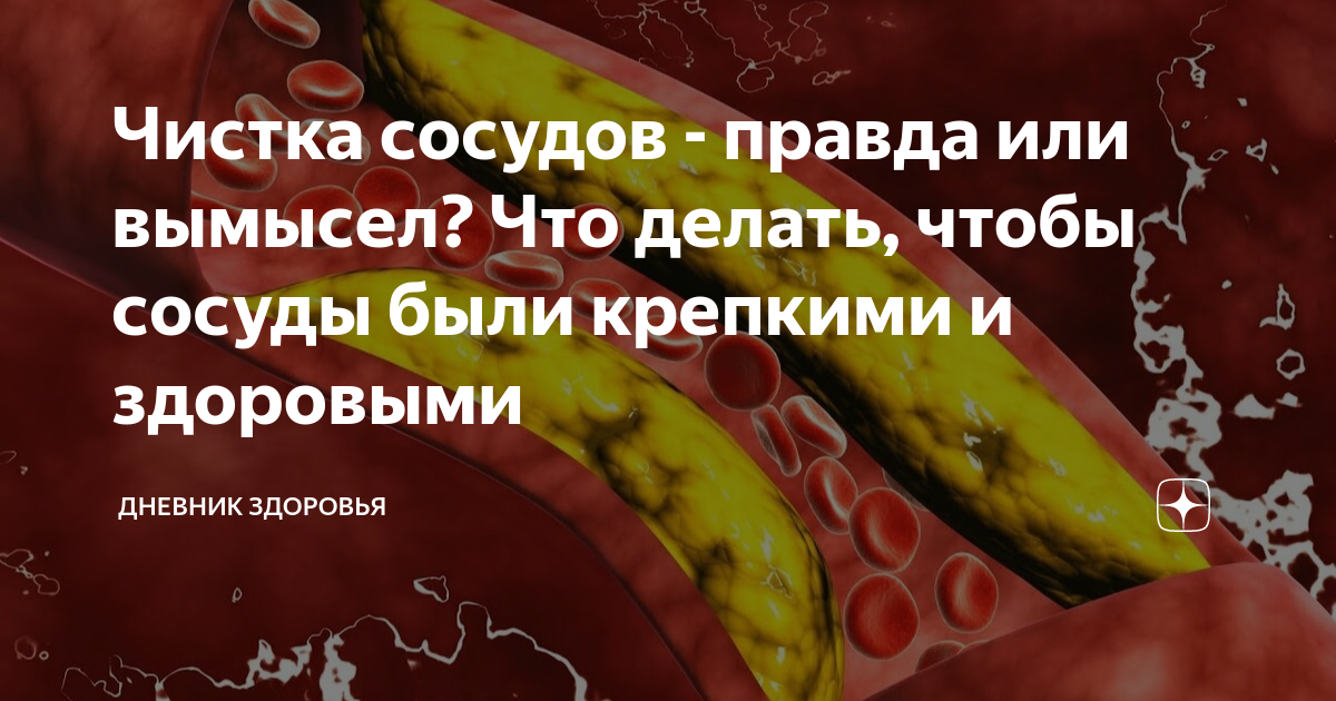 7 правил для сохранения молодости сосудов с возрастом