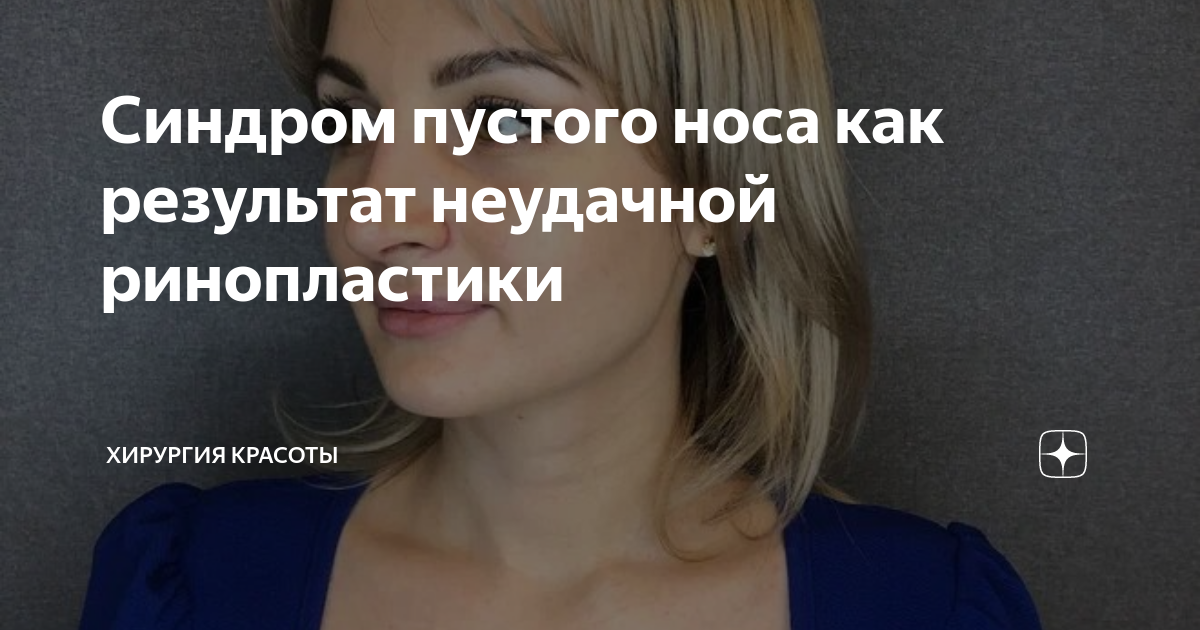 Синдром пустого носа как результат неудачной ринопластики | Хирургия ...