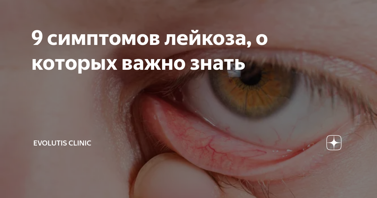 9 симптомов лейкоза, о которых важно знать | Evolutis Clinic | Дзен