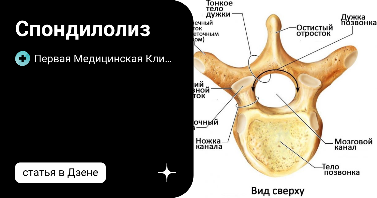 Причины возникновения