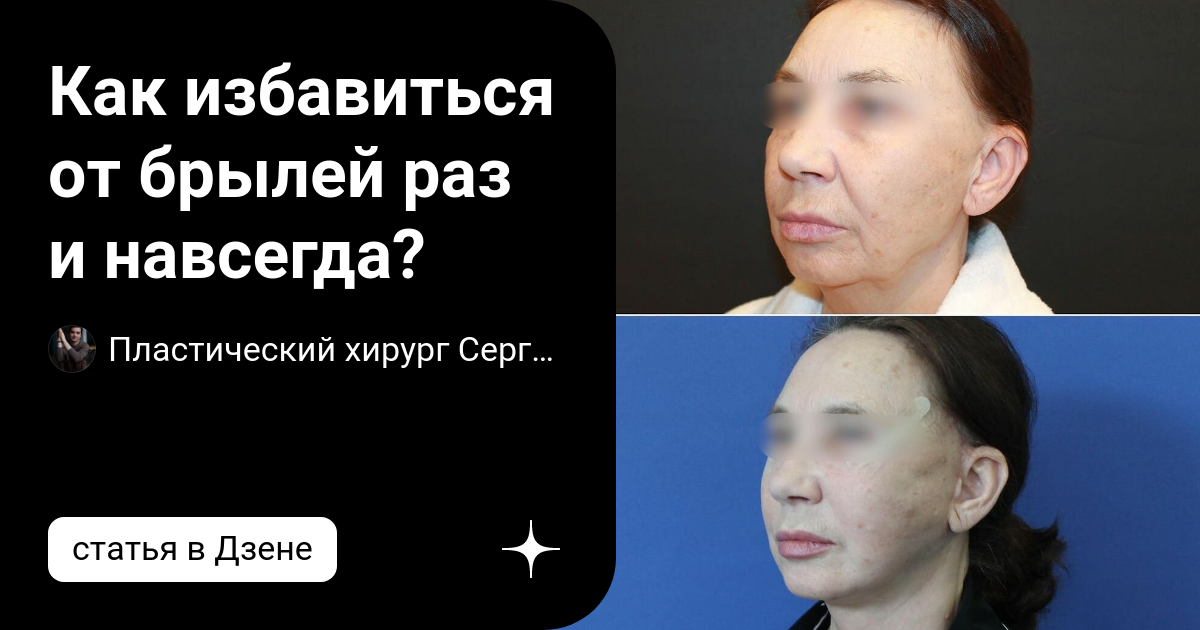 Как избавиться от брылей раз и навсегда? | Пластический хирург Сергей ...