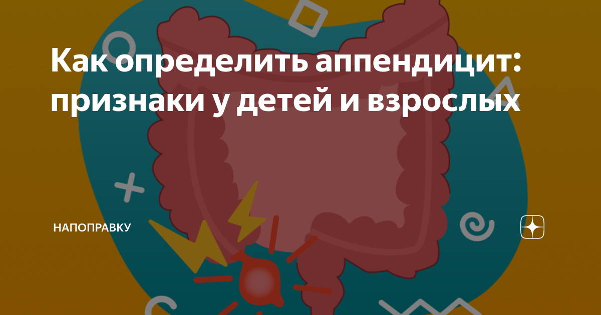 Как определить аппендицит: признаки у детей и взрослых | НаПоправку ...