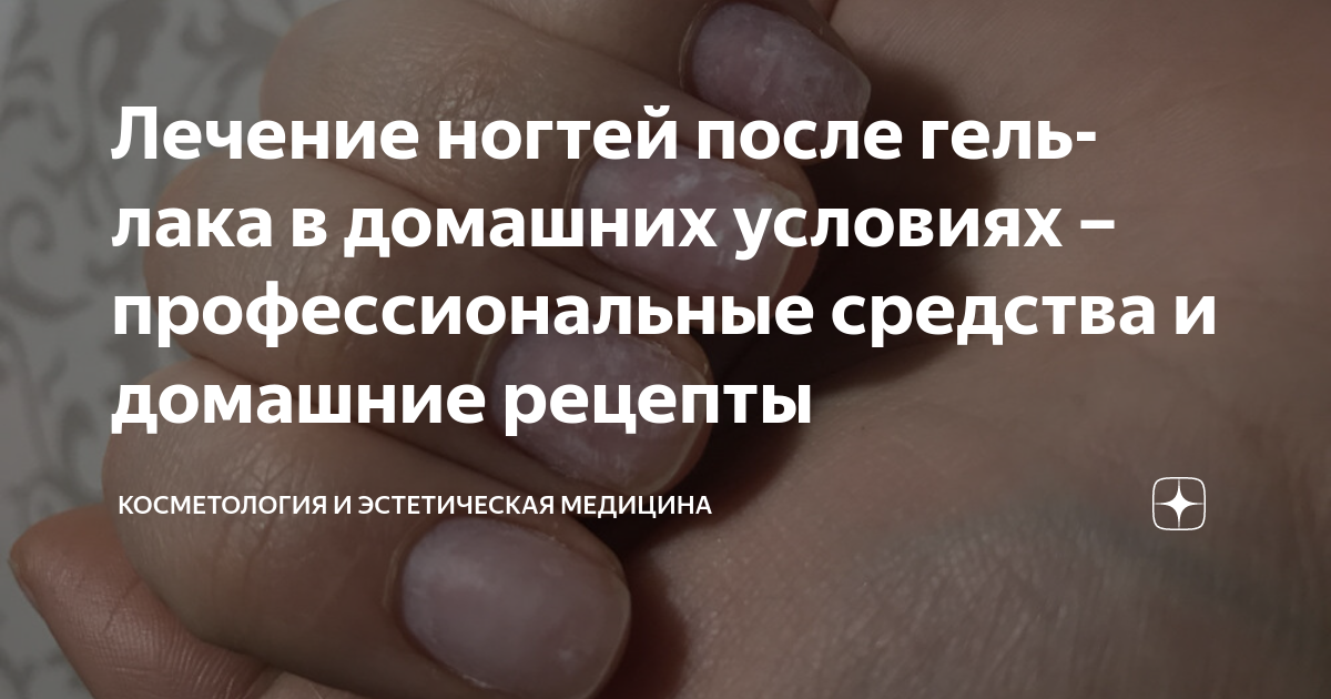 Лечение ногтей после гель-лака в домашних условиях – профессиональные ...