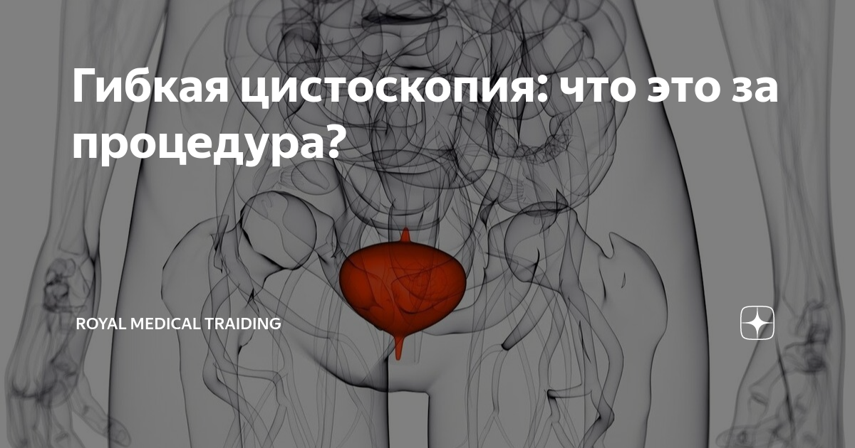 Гибкая цистоскопия: что это за процедура? | Royal Medical Traiding ...