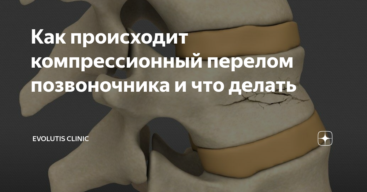 Как происходит компрессионный перелом позвоночника и что делать ...