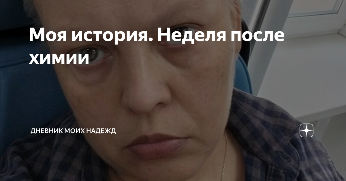 Моя история. Неделя после химии | Дневник Моих Надежд | Дзен