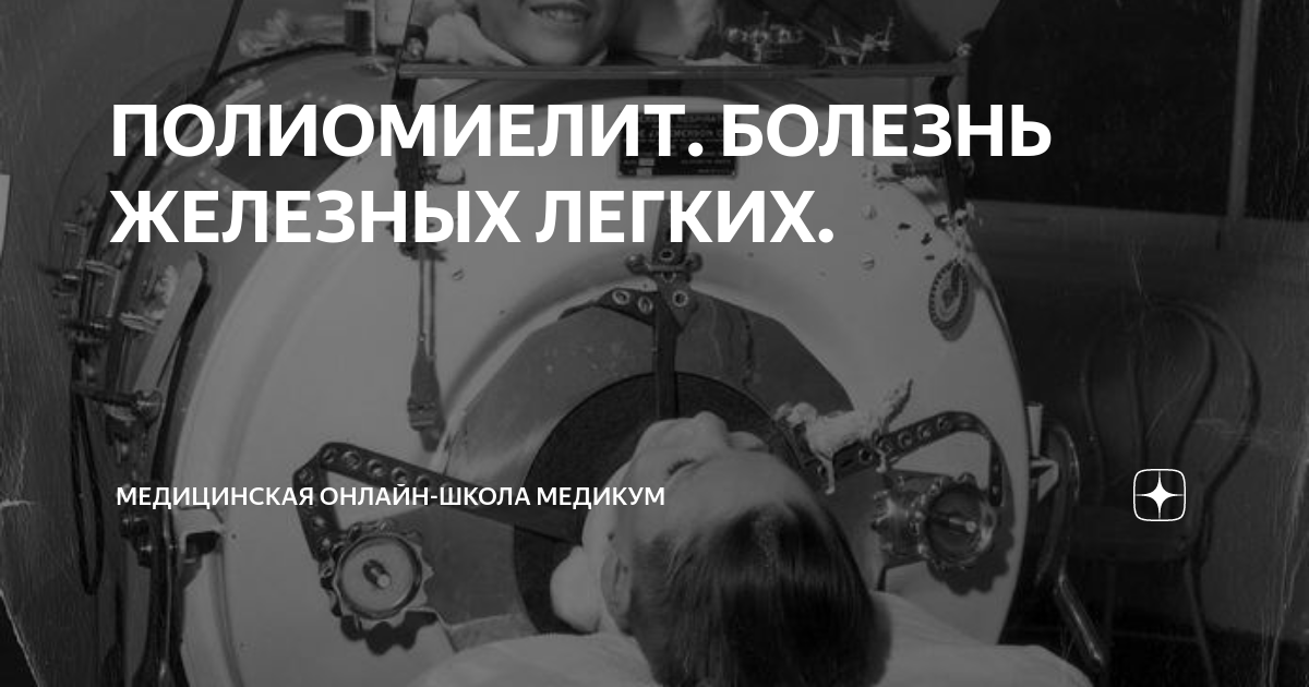 ПОЛИОМИЕЛИТ. БОЛЕЗНЬ ЖЕЛЕЗНЫХ ЛЕГКИХ. | Медицинская онлайн-школа ...