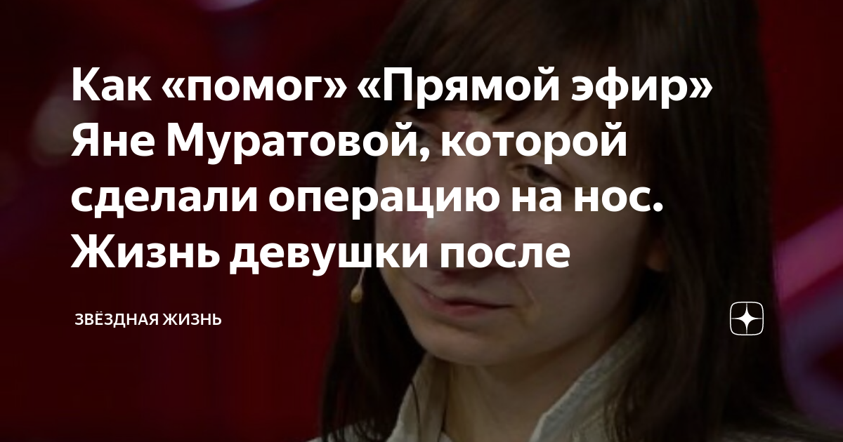 Яна Муратова После Операции На Носу Фото - Karevaphoto.ru