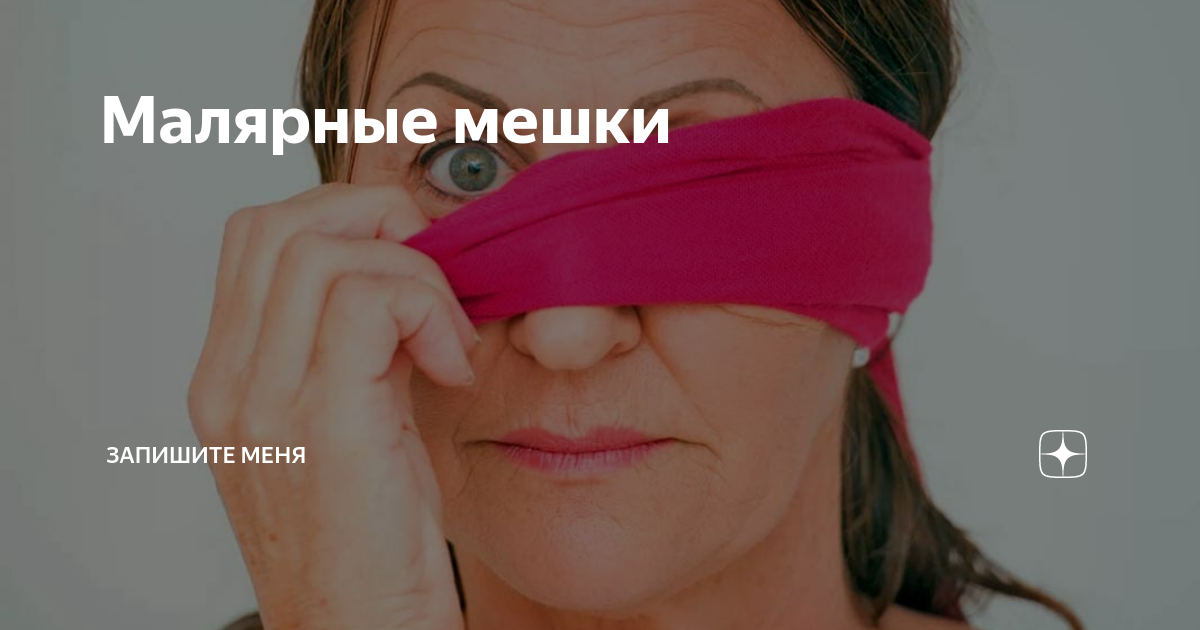Малярные мешки | Запишите меня | Дзен