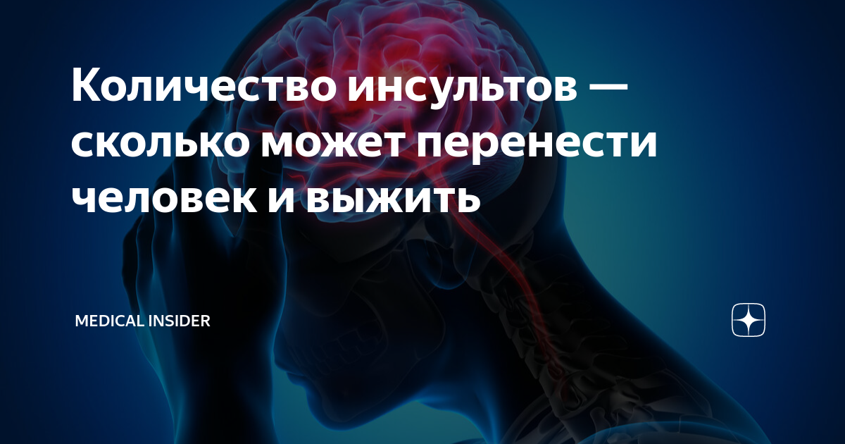 Во сколько инсульт. Сколько инсультов может пережить человек. Максимальное количество инсультов у одного человека. Сколько может быть инсультов у человека за всю жизнь.