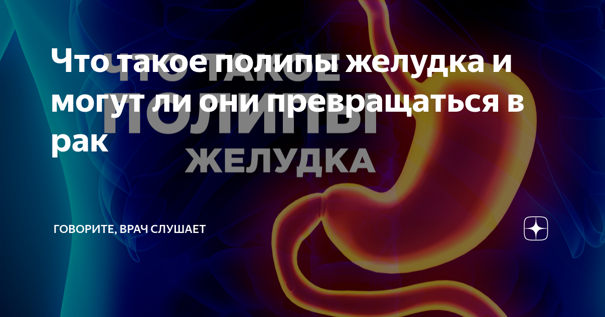 код мкб полип желудка