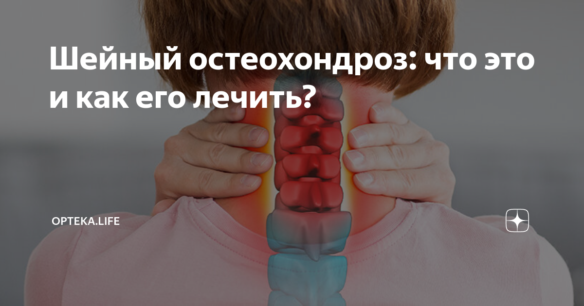 Лечение шейного остеохондроза печеным луком. Что такое остеохондроз Чем опасен шейный остеохондроз, если его не лечить, фото, видео Шейный остеохондроз у мужчин 50 лет: симптомы, причины и методы лечения.