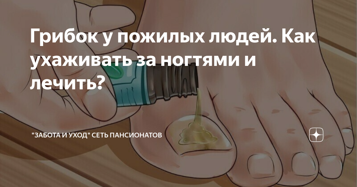 Грибок у пожилых людей. Как ухаживать за ногтями и лечить? | "Забота и ...