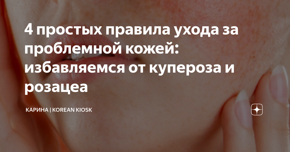 4 простых правила ухода за проблемной кожей: избавляемся от купероза и ...