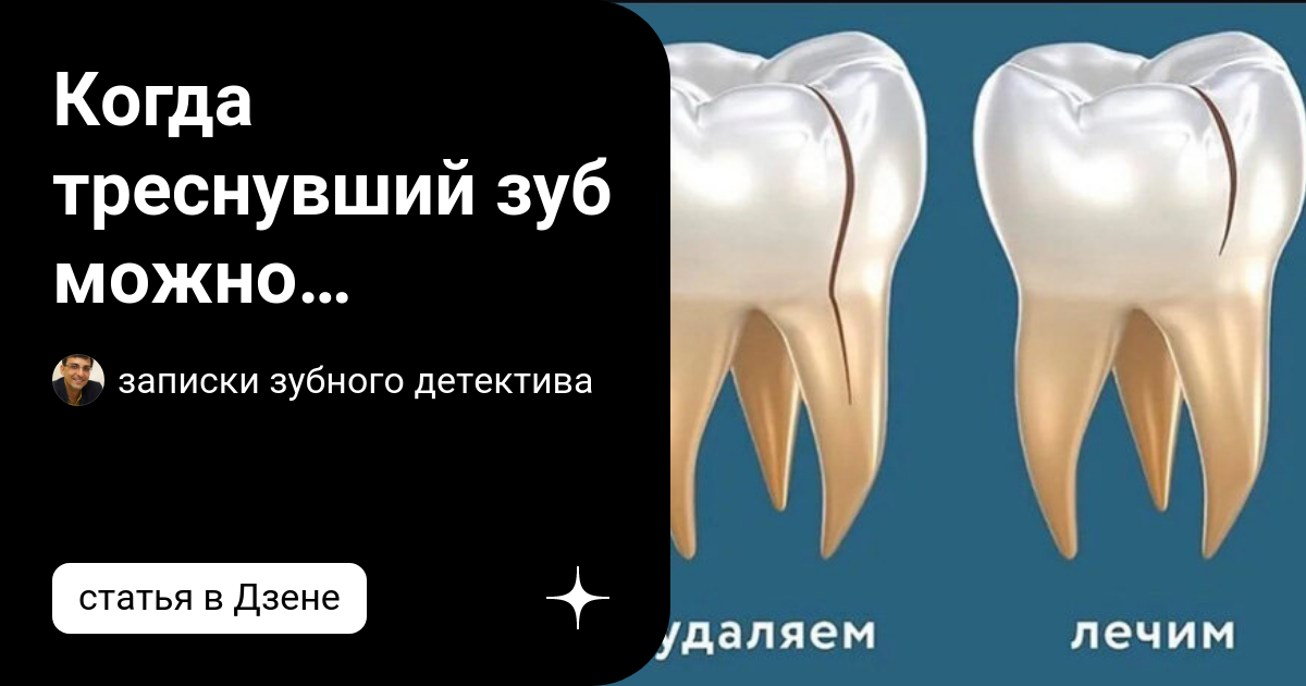 треснувший зуб арктического