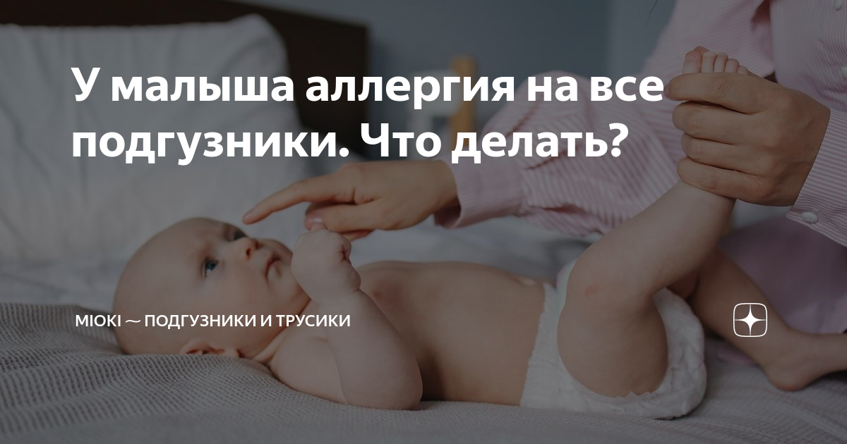 Как выглядит аллергия у новорожденного на памперс Подгузники Pampers Premium Care "То, что нам подходит!" отзывы