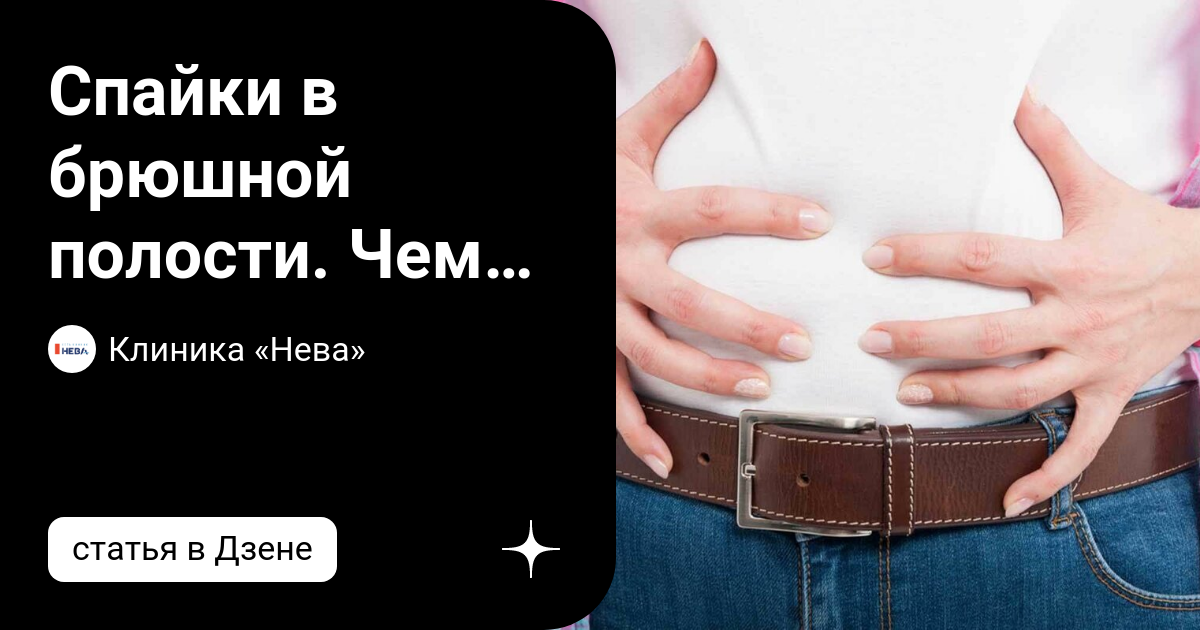 Спайки в брюшной полости. Чем могут быть опасны? | Клиника «Нева» | Дзен