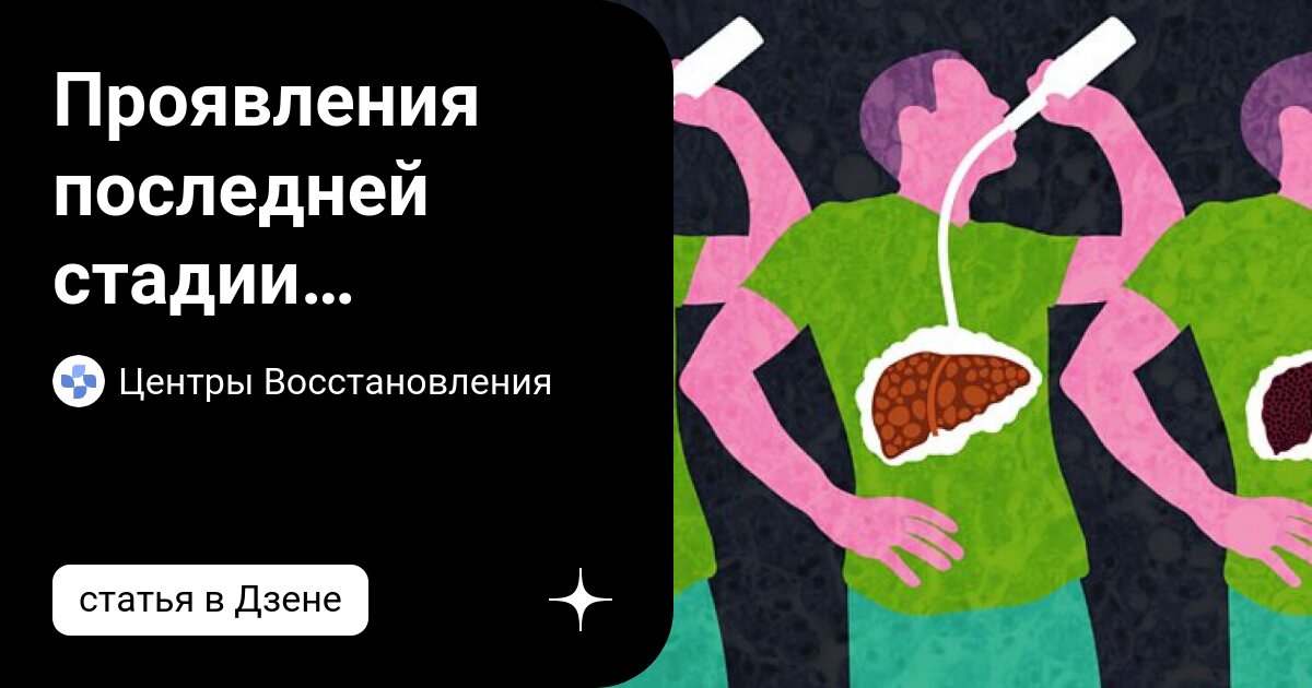 алкаш арт. белая горячка алкогольный делирий. изабела видович последний рубеж. картина пьяница. одейя раш посвященный.