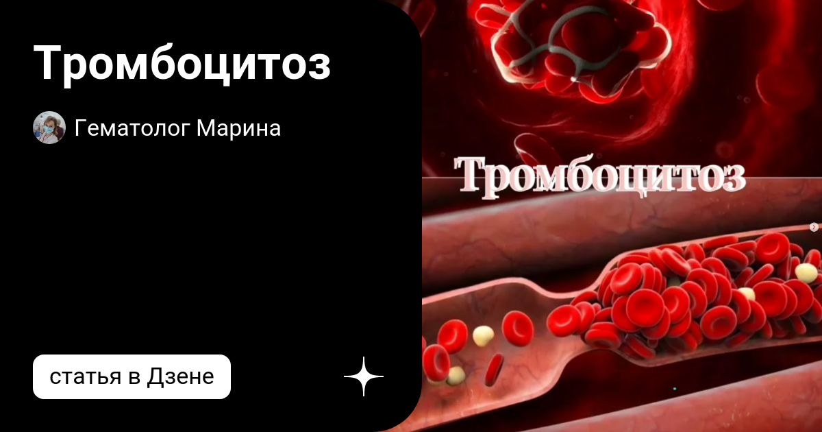 Thrombocytosis латынь