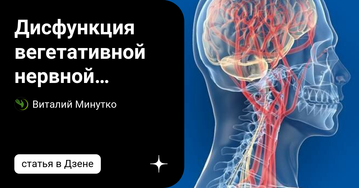 Дисфункция вегетативной нервной системы (вегетативная дистония ...