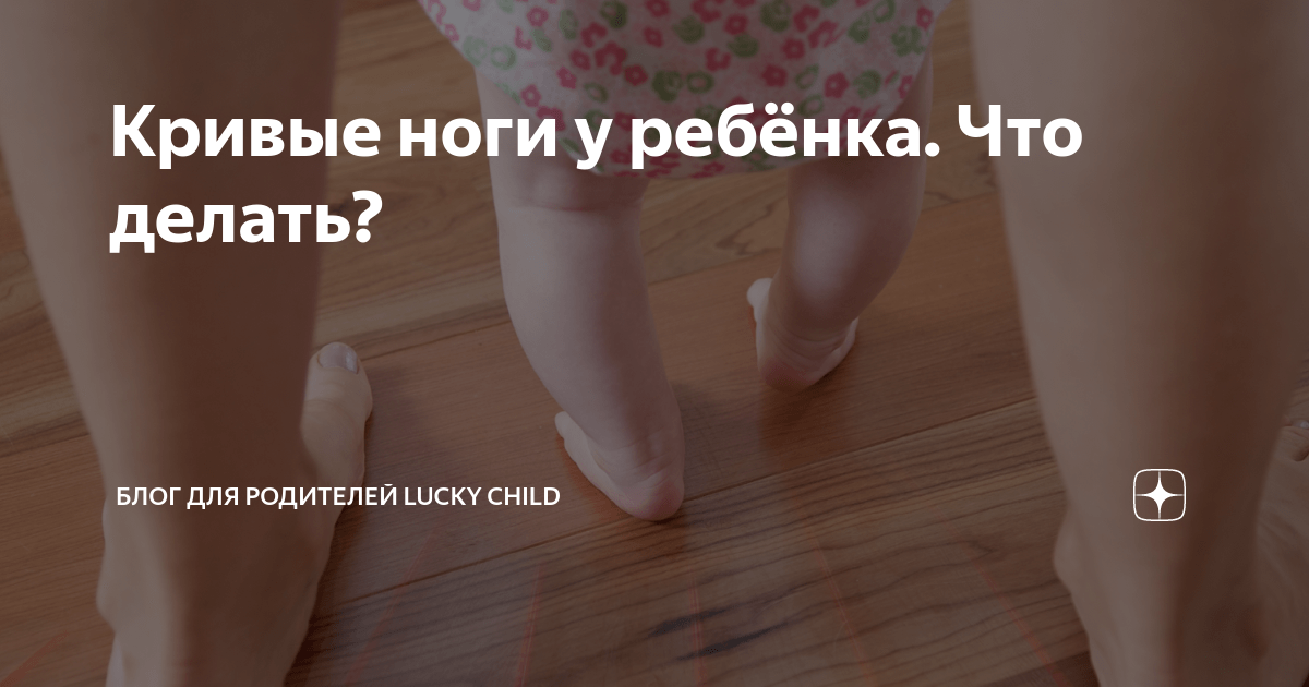 Как быть, если родителей беспокоит искривление ног ребенка