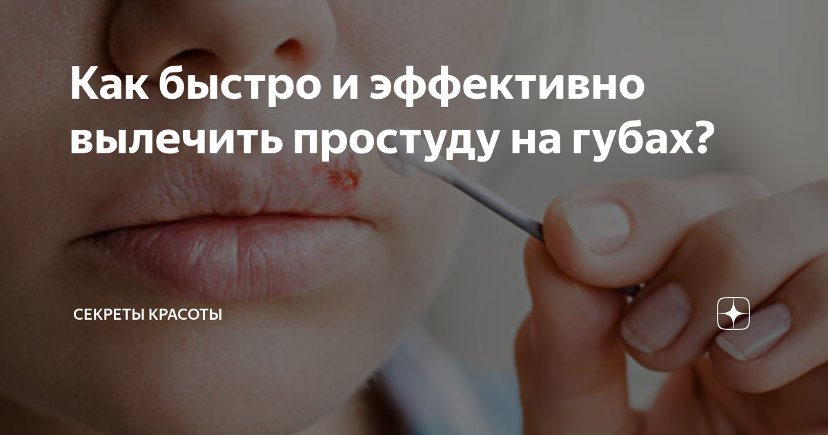 Простуда: симптомы, лечение в домашних условиях, профилактика - FitoBlog