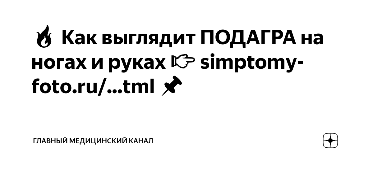 Зрелище - не из приятных. Увидела мои руки знакомая и обрадовала: "Не переживай.