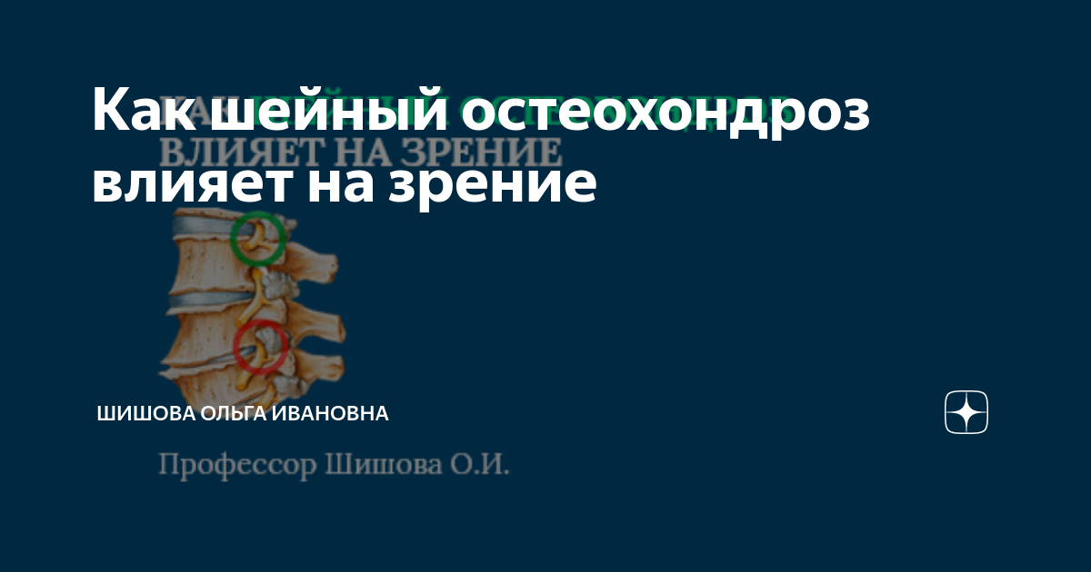 Проблемы с глазами? – Вам к неврологу! статья на сайте Преображенской клиники