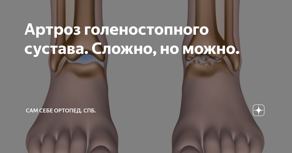 Боль в голеностопе: причины, симптомы и лечение