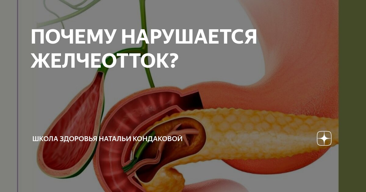 Продукты для желчеоттока. Почему нарушается желчеотток. Желече отток.