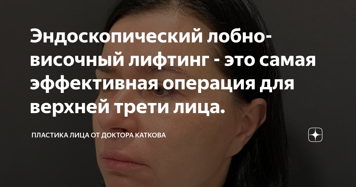 Эндоскопический лобно-височный лифтинг - это самая эффективная операция ...