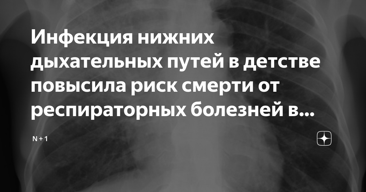 Инфекция нижних дыхательных путей в детстве повысила риск смерти от ...