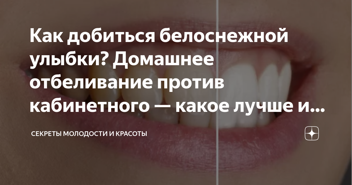 Как добиться белоснежной улыбки? Домашнее отбеливание против