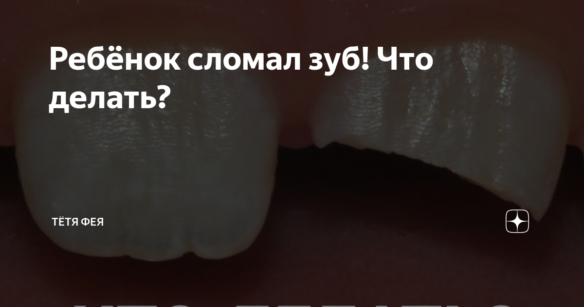 Ребенок выбил или сломал зуб. Что делать?