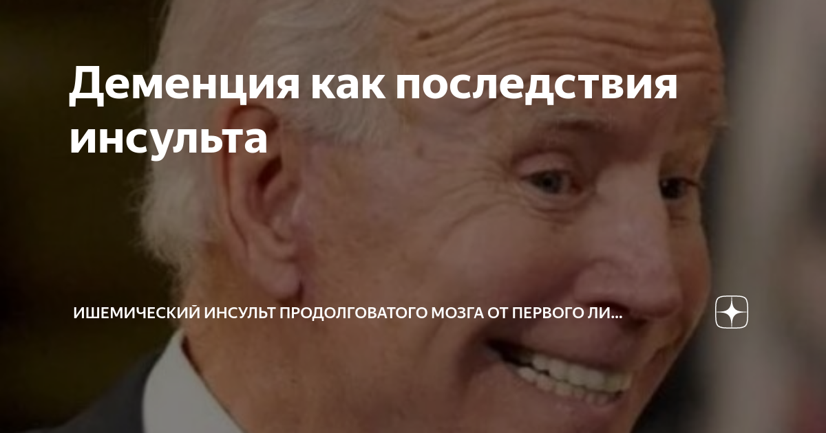 Деменция как последствия инсульта | Ишемический инсульт продолговатого ...