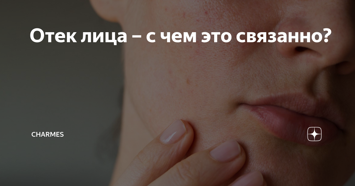 Отек лица – с чем это связанно? | Charmes | Дзен