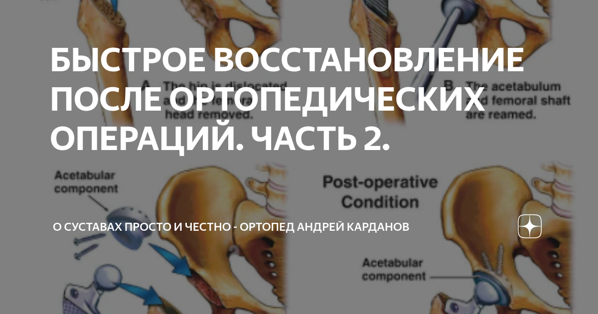 Ортопед карданова