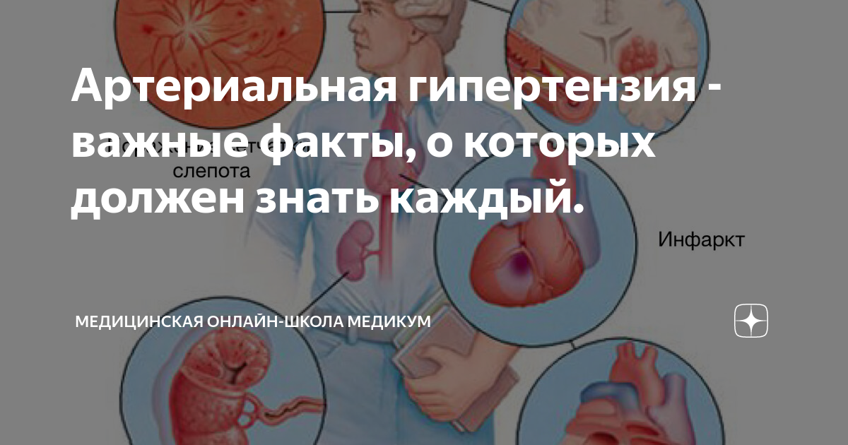 Артериальная гипертензия - важные факты, о которых должен знать каждый ...