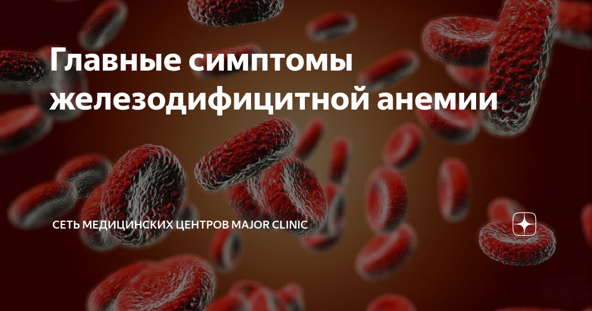 шум в ушах при железодефицитной анемии