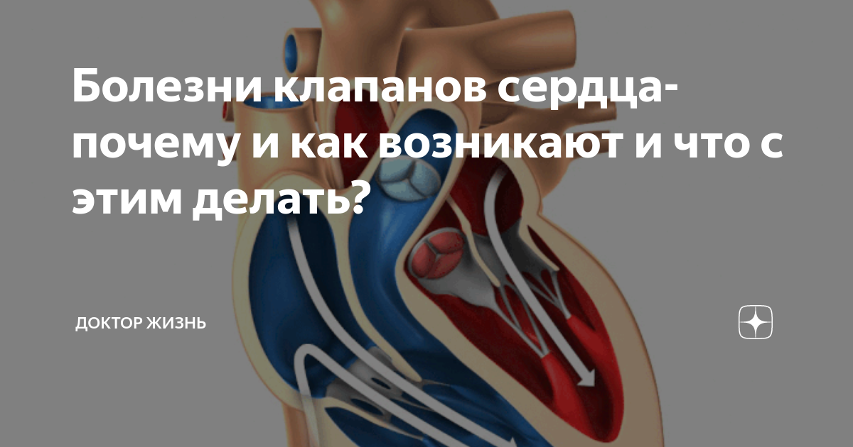 Митральный и трикуспидальный клапан