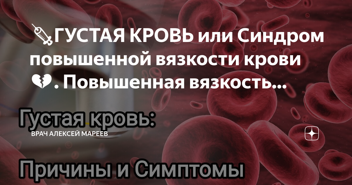 Синдром повышенной вязкости. Повышение вязкости крови причины. Препараты при повышенной вязкости крови. Повышение вязкости крови повышение глобулинов. Факторы повышающие вязкость крови альбумины.