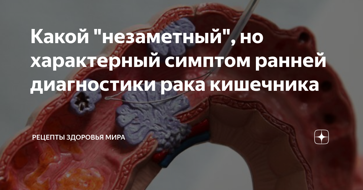неспецифические заболевания кишечника