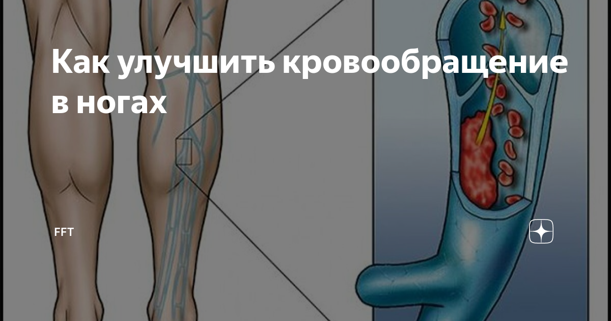 улучшить кровообращение в ногах. упражнения для улучшения кровообращения в ногах для женщин. упражнения для улучшения кровоснабжения ног. улучшение кровообращения в ногах. самомассаж ноги для улучшения кровообращения.