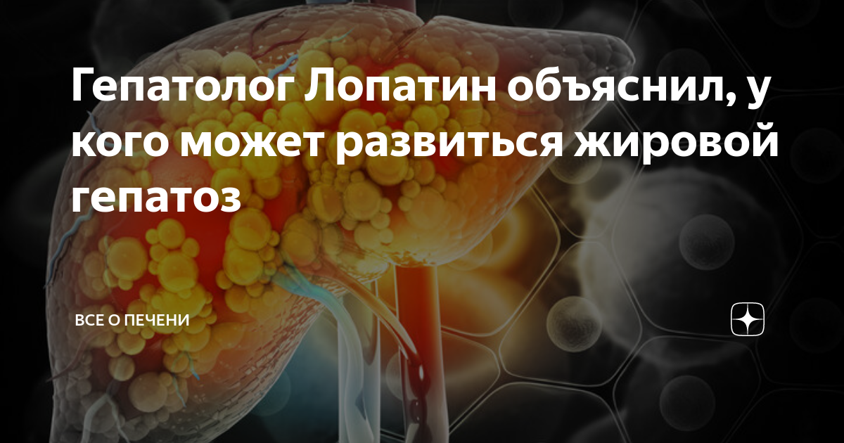 Гепатолог Лопатин объяснил, у кого может развиться жировой гепатоз ...
