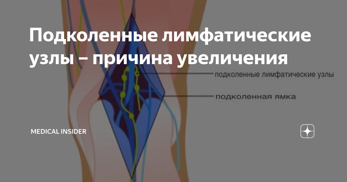 Как лечить увеличенный лимфатический узел Картинки ПОДМЫШЕЧНЫЕ ЛИМФОУЗЛЫ СХЕМА